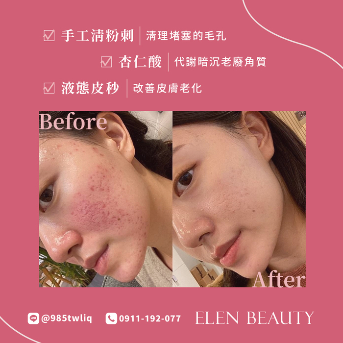 伊卡絲 ECSALON圖片